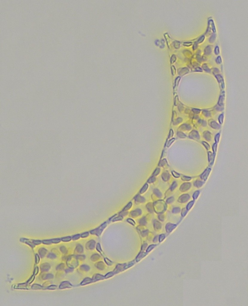 Foto de microscopía de Chaetoceros enviada por WhatsApp